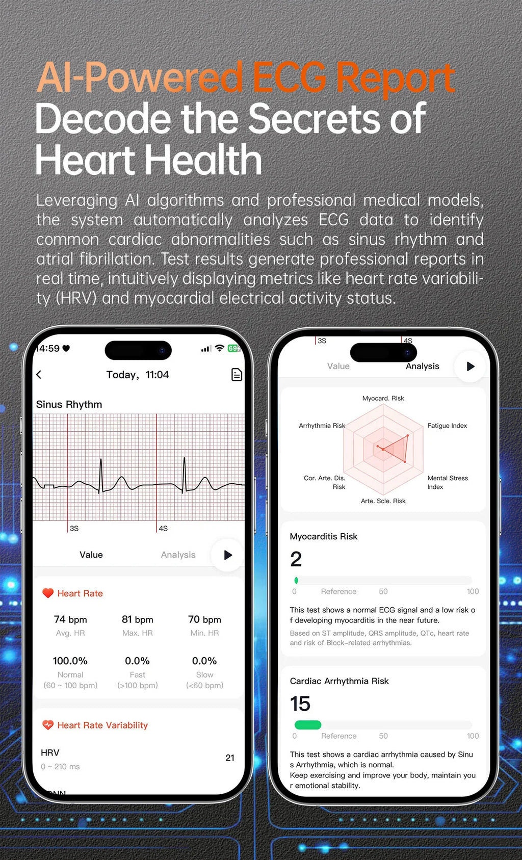 2025 New ECG+PPG Health Diagnosis Smartwatches Men Women Clock Uric Acid Lipid BP Heart rate Tracker NFC Sports Smart Watch IOS