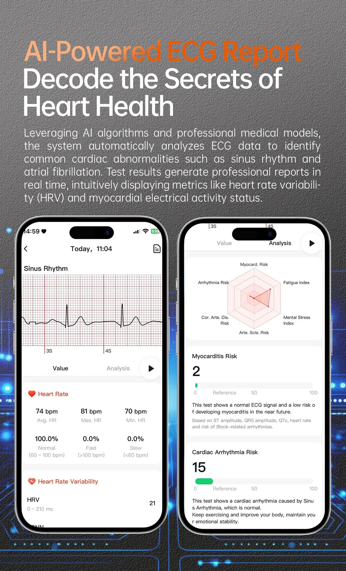 2025 New ECG+PPG Health Diagnosis Smartwatches Men Women Clock Uric Acid Lipid BP Heart rate Tracker NFC Sports Smart Watch IOS