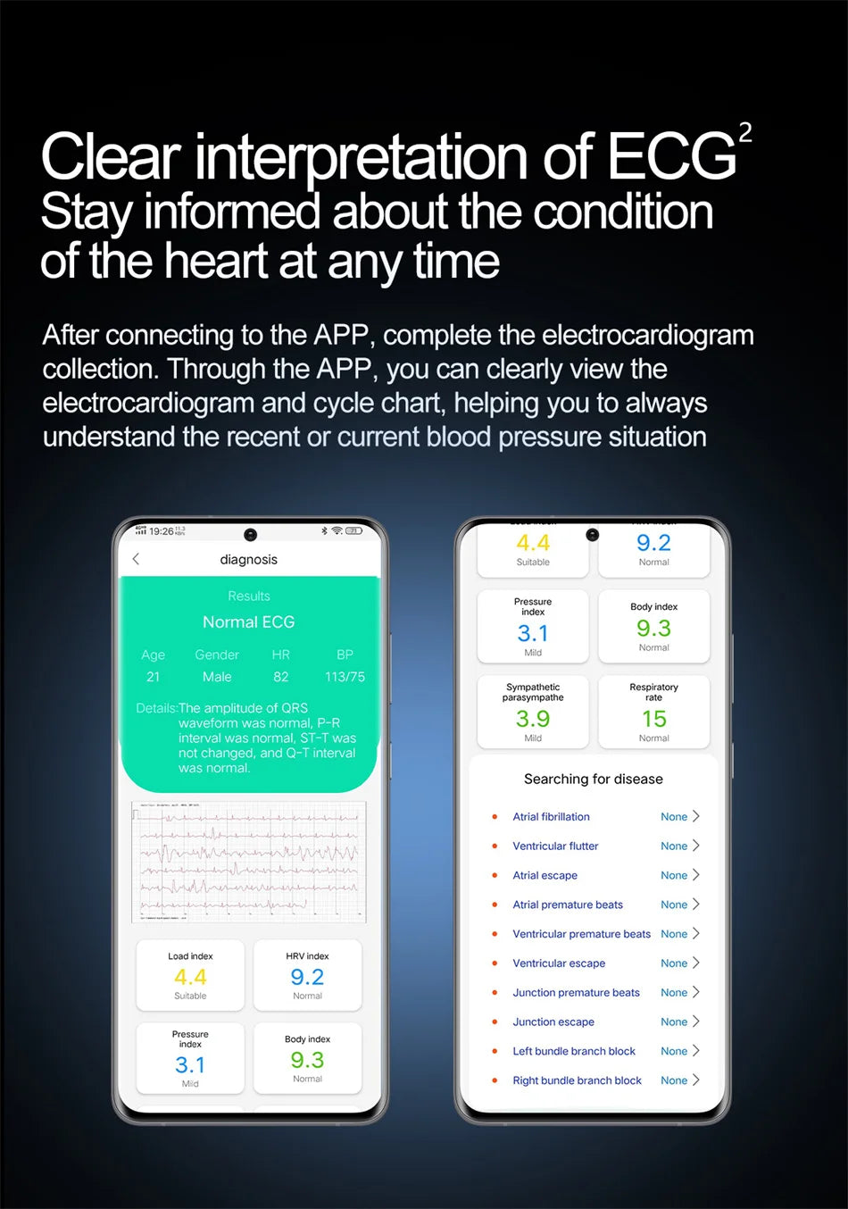 New AI Diagosis ECG Health Smart Watch Men Blood Pressure Lipid Uric Acid NFC Air Pump Airbag Health Smartwatches For men Women